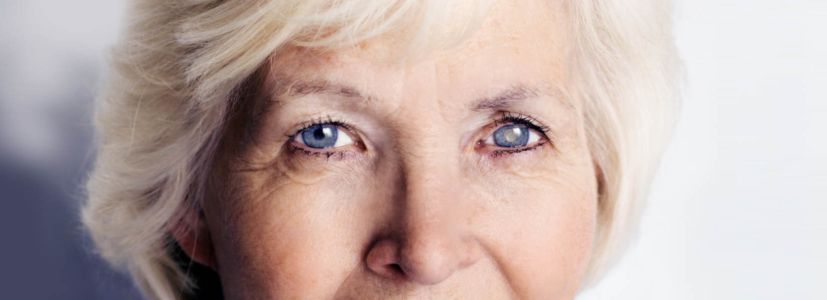 Cataract Surgery in Mars